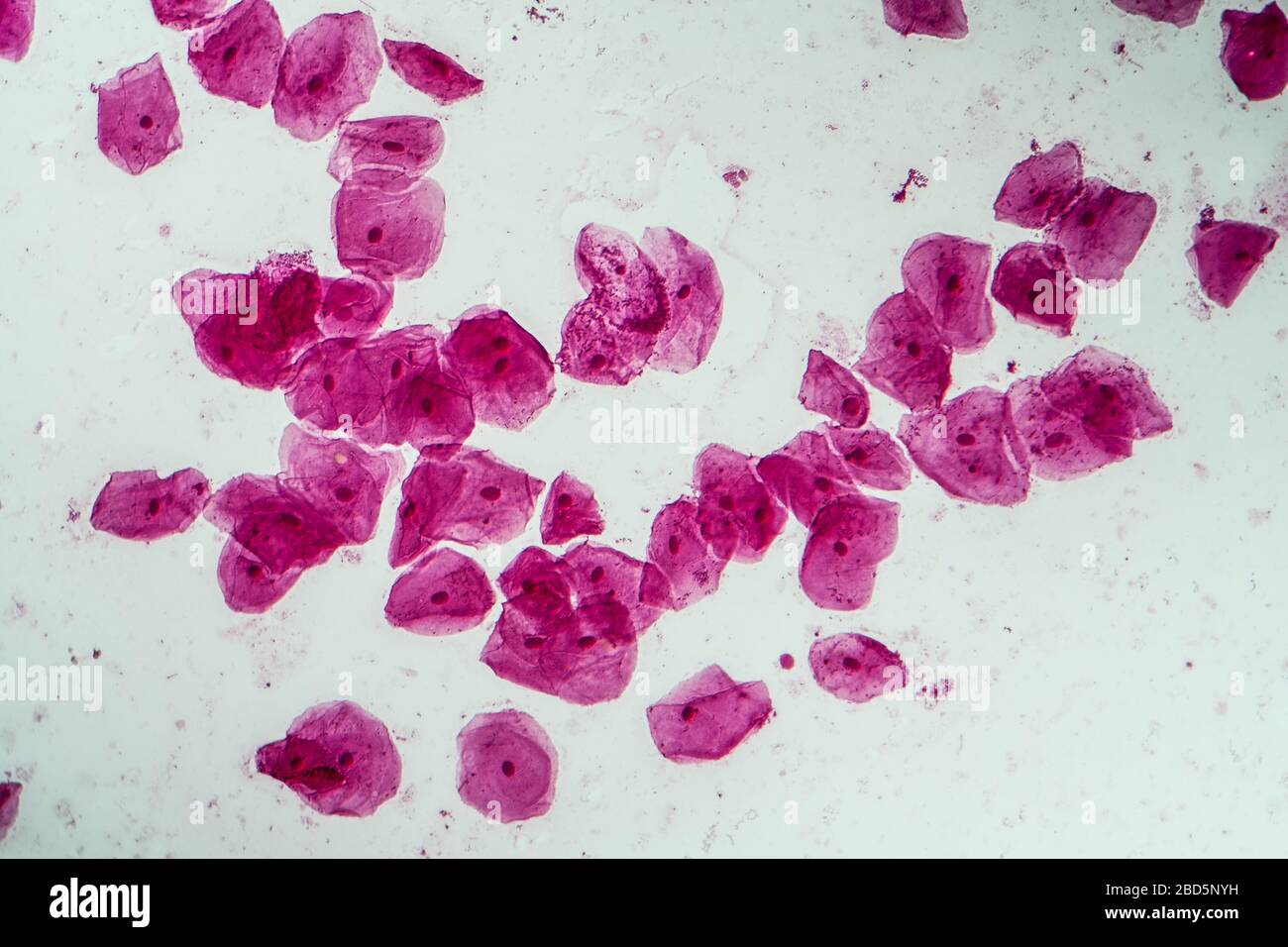 Le cellule epiteliali con batteri dalla cavità orale 200x Foto Stock