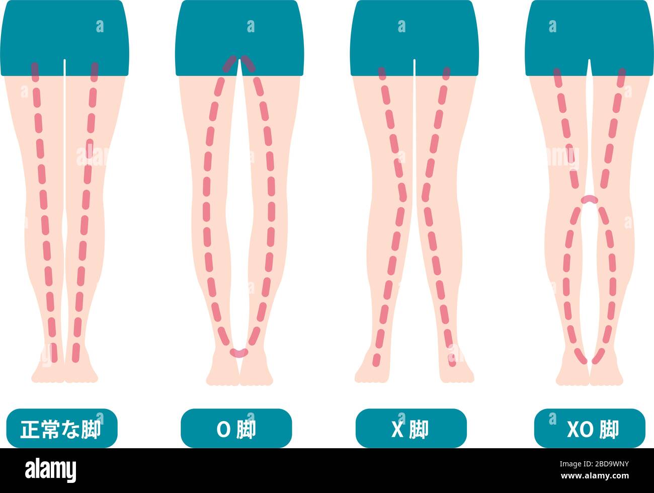 Tipi di differenza di angoli delle gambe e delle ginocchia, illustrazione vettoriale (giapponese) Illustrazione Vettoriale