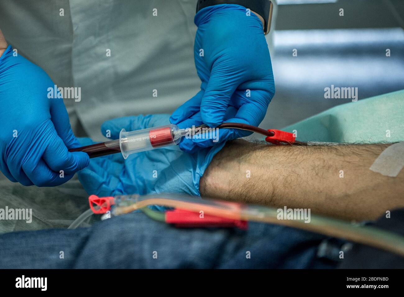 Pavia, Italia. 8 aprile 2020. Pavia. Trasfusione di plasma da un paziente recuperato da COVID19 ad un paziente infetto da coronavirus trattamento sperimentale diretto dal medico Cesare Perotti presso l'Ospedale Policlinico San Matteo di Pavia (Carlo Cozzoli/Fotogramma, Pavia - 2020-04-08) p.s. la foto e' utilizzabile nel ripetto del contesto in cui e' sta scattata, E senza intenzione diffamatorio del decore delle persone rappresentate Credit: Independent Photo Agency Srl/Alamy Live News Foto Stock