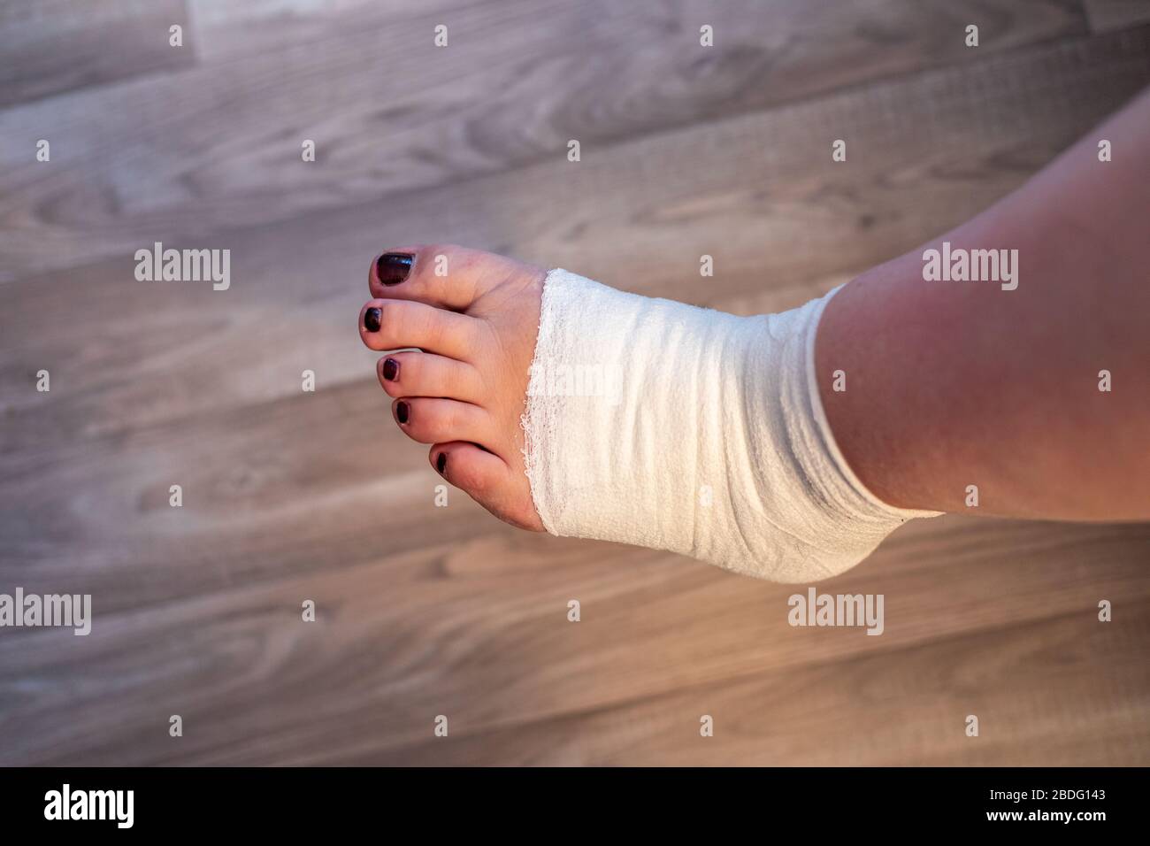 Femmina sta avvolgendo la sua ferita del piede con bendaggio Foto Stock