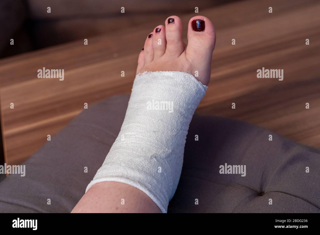 Femmina sta avvolgendo la sua ferita del piede con bendaggio Foto Stock