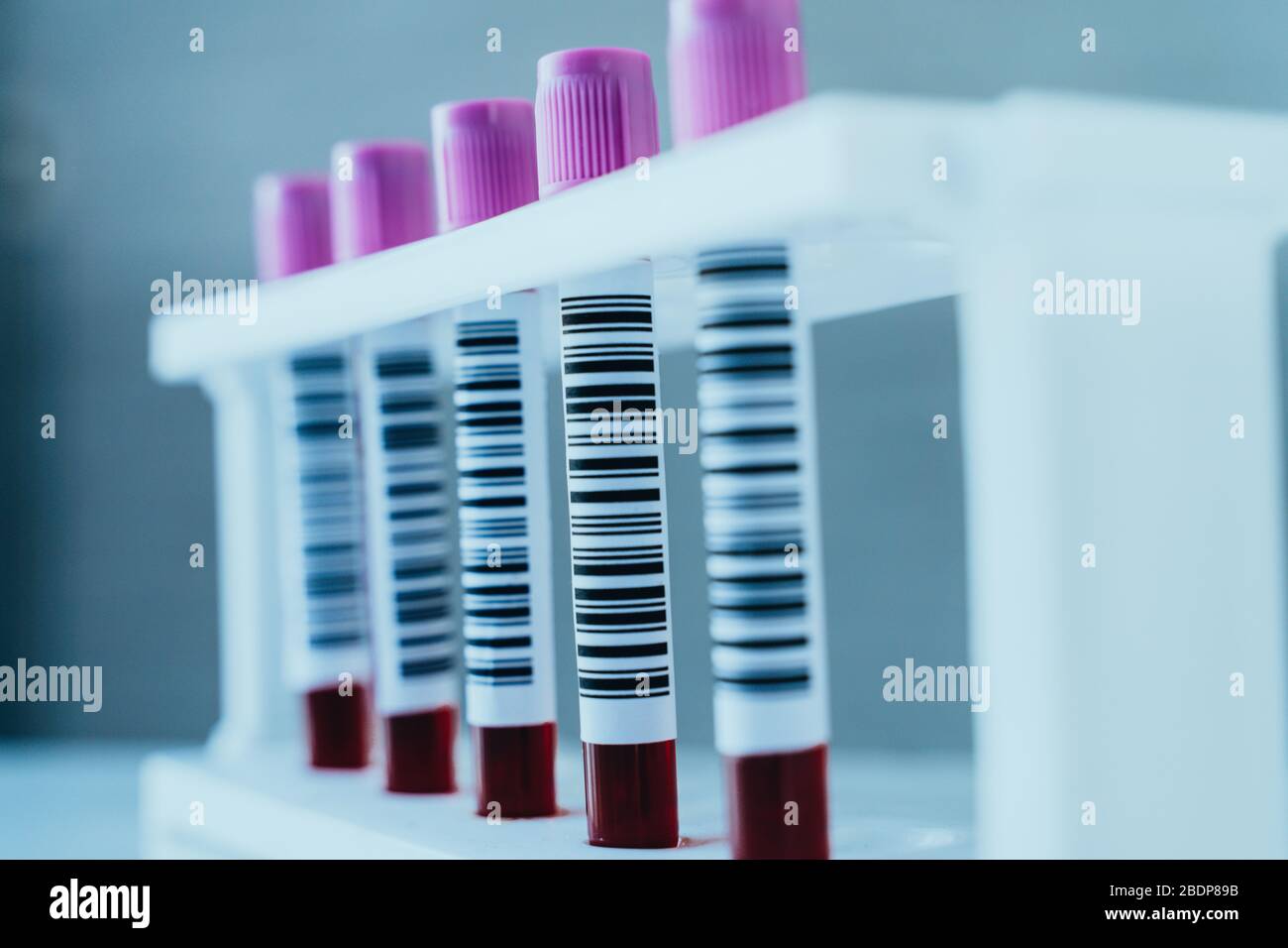 Provette per analisi del sangue in un rack per analisi del sangue di laboratorio. Scienza e concetto medico. Foto Stock