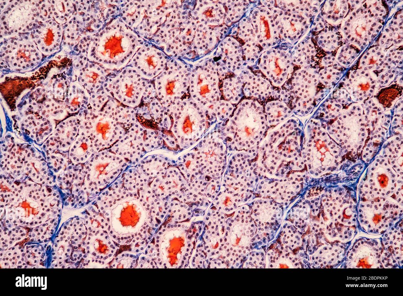 Il tessuto tiroide sotto il microscopio 200x Foto Stock