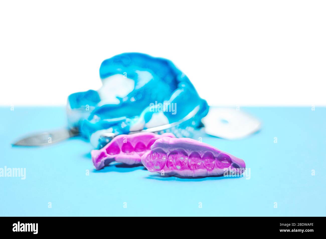 Due impressioni dentali su sfondo bianco e blu. L'impronta della fila di denti di pezzi di registrazione ad alta precisione e morso Foto Stock