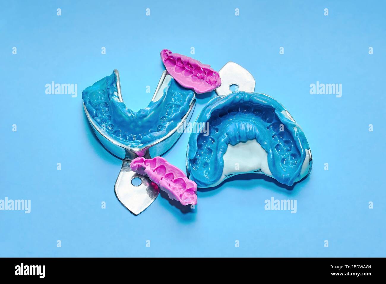 Due impressioni dentali su sfondo bianco e blu. L'impronta della fila di denti di pezzi di registrazione ad alta precisione e morso Foto Stock