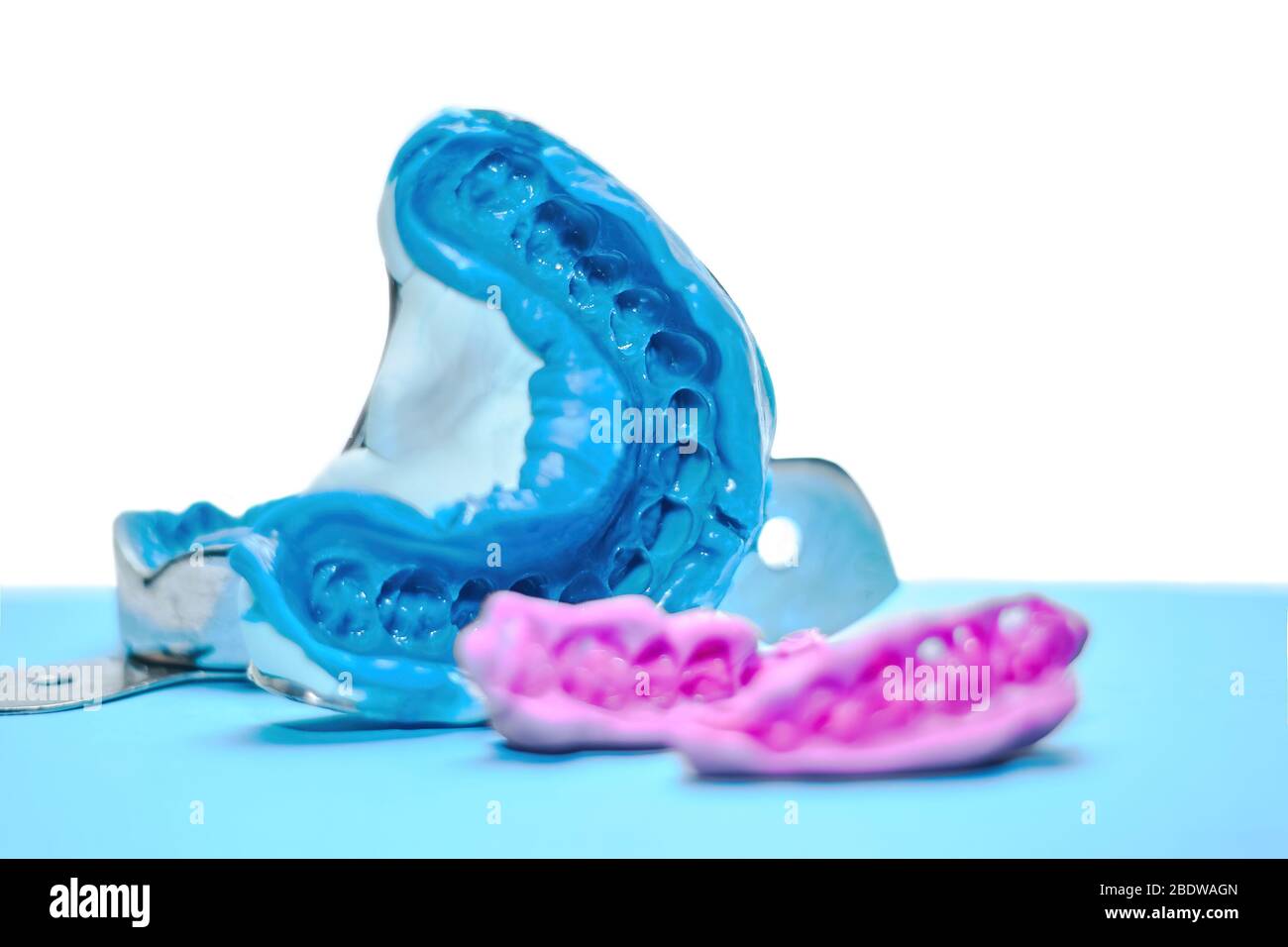 Due impressioni dentali su sfondo bianco e blu. L'impronta della fila di denti di pezzi di registrazione ad alta precisione e morso Foto Stock