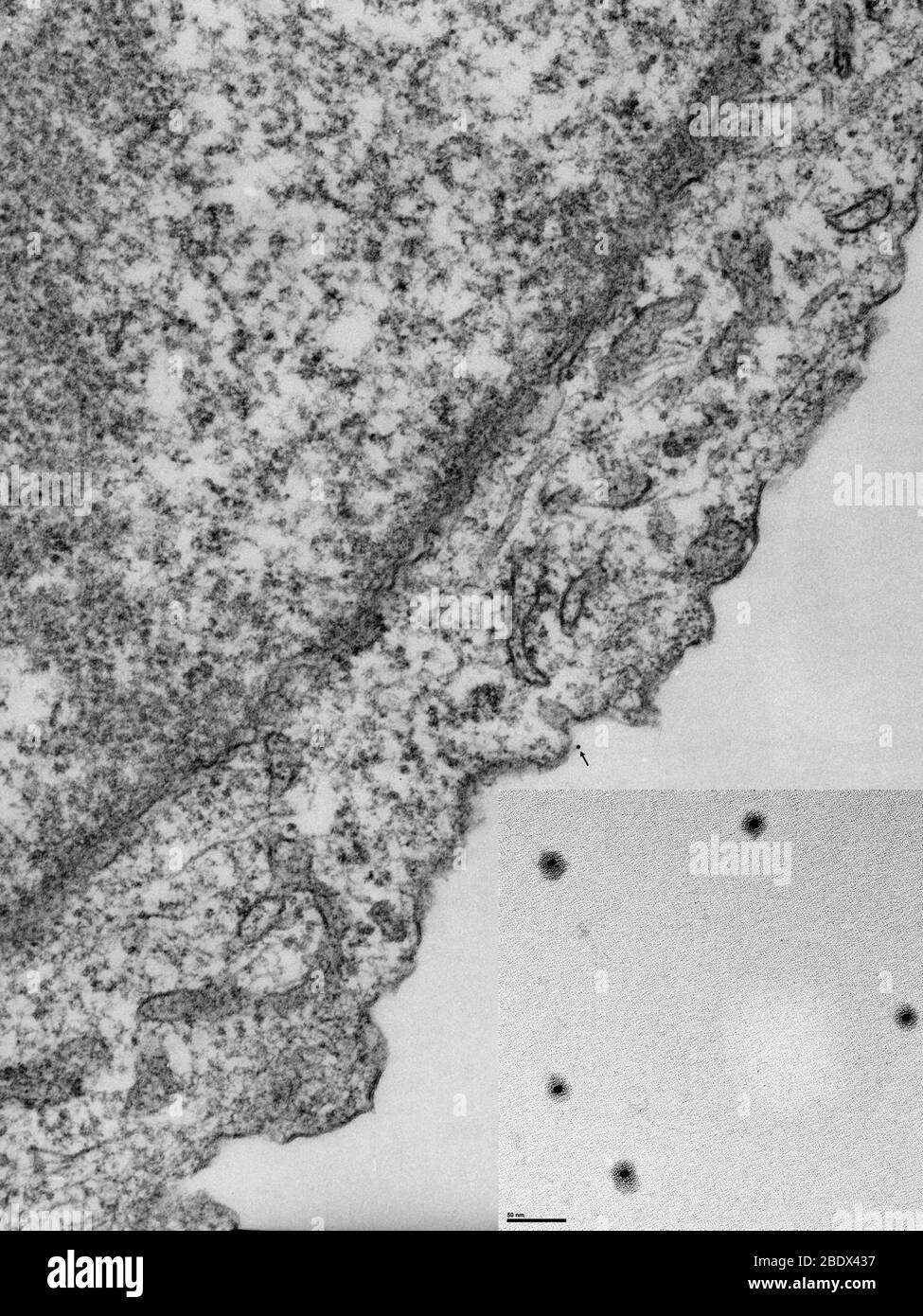Nanoparticelle che arrivano a Target in cellule del cancro del cervello, TEM Foto Stock