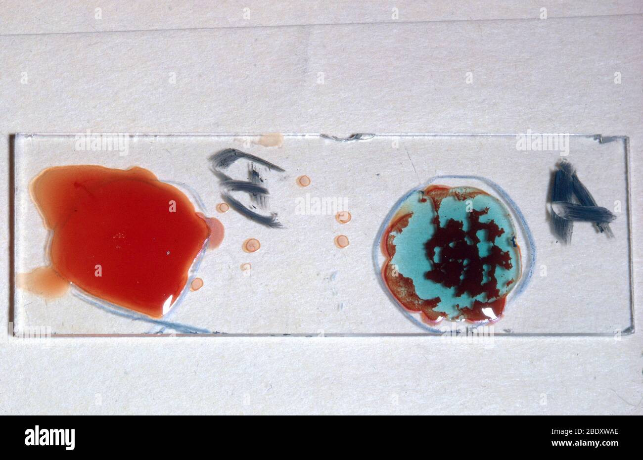 Digitando sangue umano Foto Stock