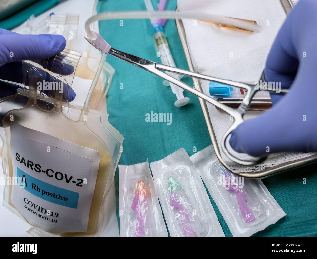 Sacca per plasma con anticorpi da persone curate di SARS-COV-2 Covid-19 preparata in un'immagine concettuale ospedaliera Foto Stock
