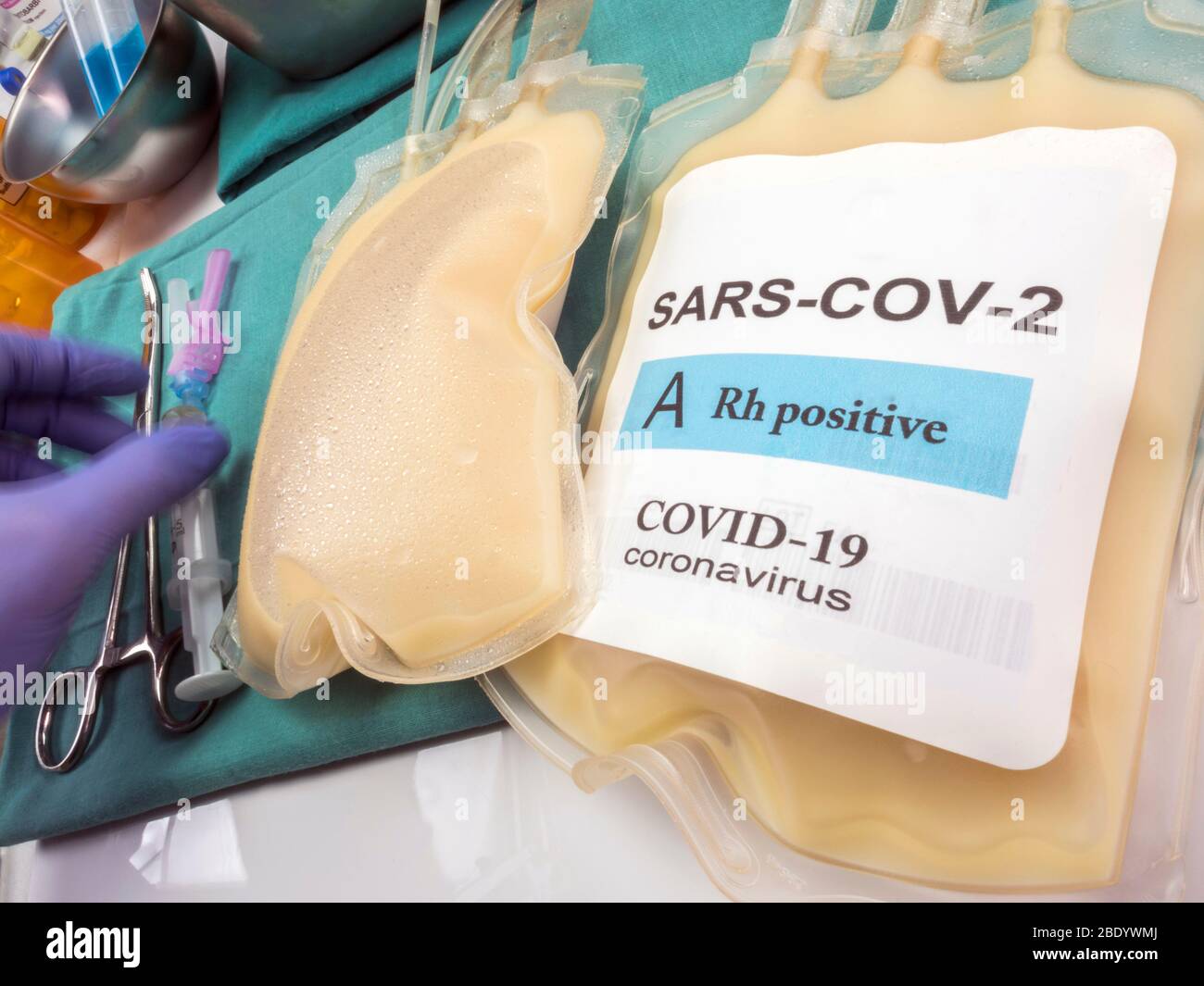 Sacca per plasma con anticorpi da persone curate di SARS-COV-2 Covid-19 preparata in un'immagine concettuale ospedaliera Foto Stock