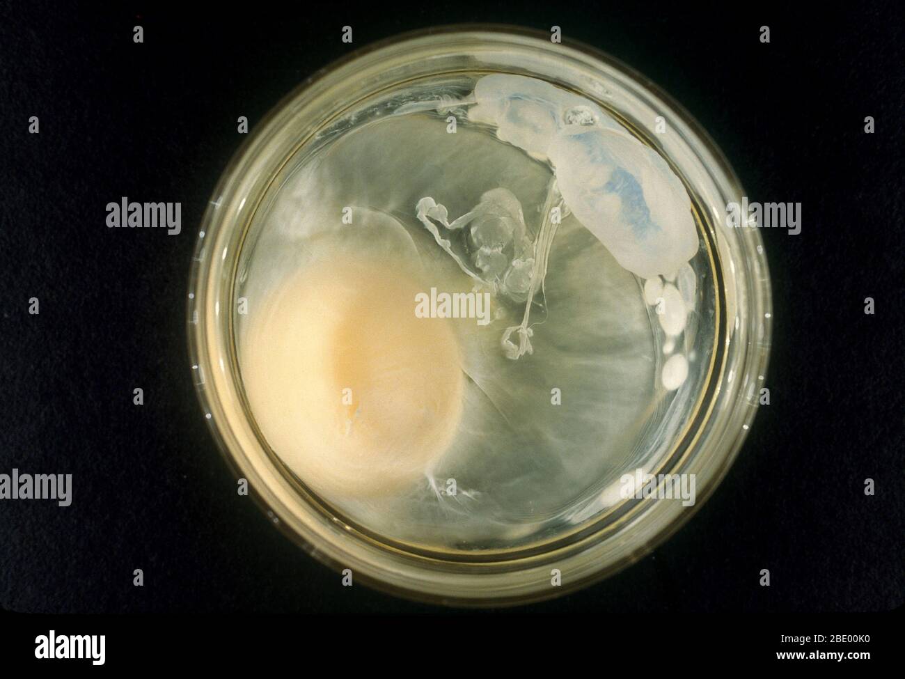 Denaturazione proteica, 2 di 4 Foto Stock