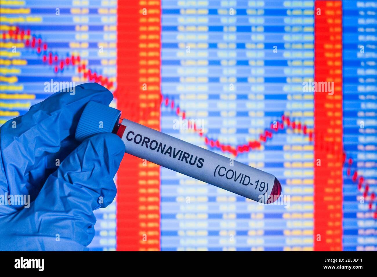 Campione di sangue di Coronavirus Covid 19 con prezzi di borsa in calo sullo sfondo Foto Stock