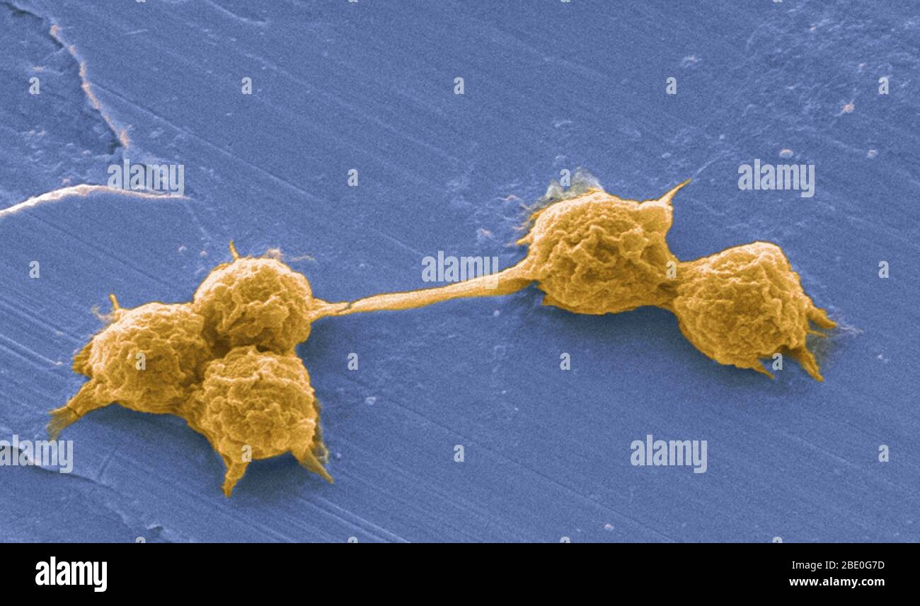 Le amebae vive (FLA) nel gruppo degli Amoebozoi sono cause importanti di malattie nell'uomo e negli animali. SEM di un biofilm di acqua potabile coltivato in laboratorio, con presenza di cisti di Vermamoeba vermiformis (Hartmanella). I batteri acquatici sono stati coltivati come biofilm su acciaio per una settimana. V. vermiformis sono stati poi aggiunti, e fagocitizzati i batteri che si sono moltiplicati all'interno delle vescicole che sono diventate cisti in cui i batteri vivranno fino a che non si rompono. Vermamoeba vermiformis un'ameba libera (FLA), è diffusa in natura ed è stata isolata dal suolo, dall'acqua dolce, dall'aria e da un Foto Stock