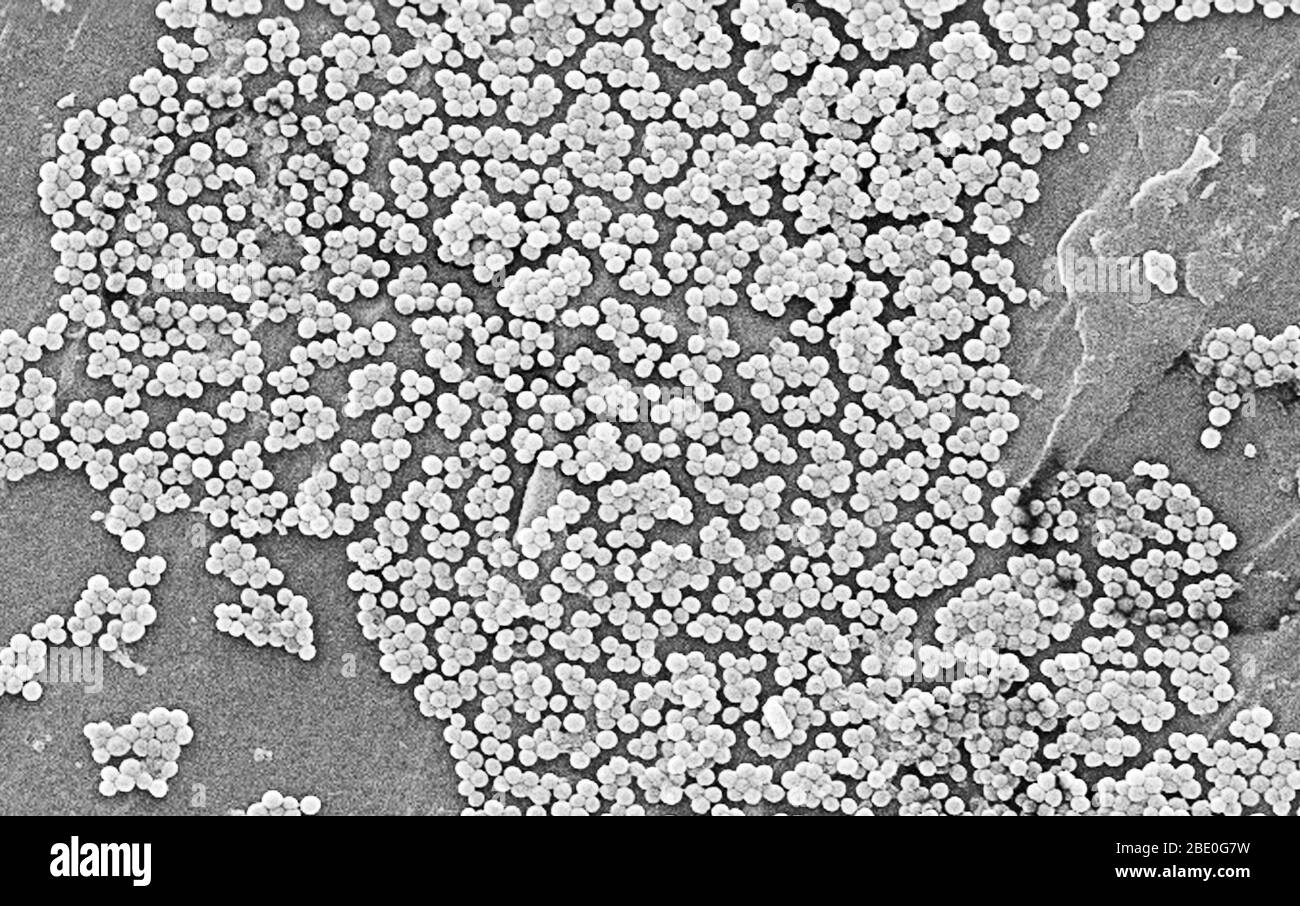Numerosi ceppi di batteri Staphylococcus aureus resistenti alla meticillina, comunemente indicati con l'acronimo MRSA. Focolai o cluster recentemente riconosciuti di MRSA in ambienti comunitari sono stati associati a ceppi che hanno alcune proprietà microbiologiche e genetiche uniche rispetto ai ceppi MRSA tradizionali basati in ospedale. Ciò suggerisce che alcune proprietà biologiche, per esempio, fattori di virulenza come le tossine, possono permettere che i ceppi della comunità si diffondano più facilmente o causino più malattia della pelle. Un ceppo comune denominato USA300-0114 ha causato molti focolai di questo tipo negli Stati Uniti. Staphylococcc Foto Stock