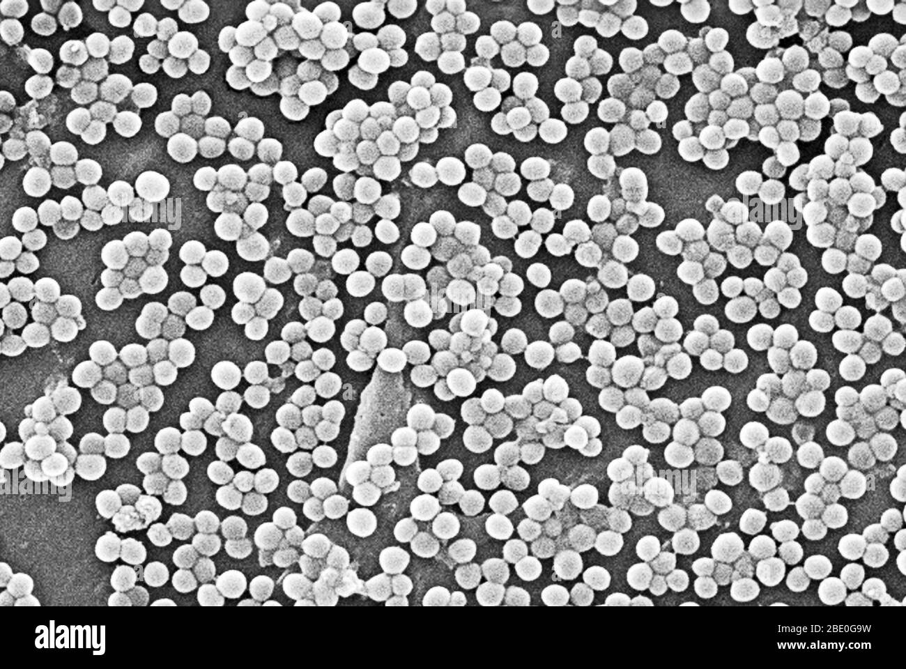 Numerosi ceppi di batteri Staphylococcus aureus resistenti alla meticillina, comunemente indicati con l'acronimo MRSA. Focolai o cluster recentemente riconosciuti di MRSA in ambienti comunitari sono stati associati a ceppi che hanno alcune proprietà microbiologiche e genetiche uniche rispetto ai ceppi MRSA tradizionali basati in ospedale. Ciò suggerisce che alcune proprietà biologiche, per esempio, fattori di virulenza come le tossine, possono permettere che i ceppi della comunità si diffondano più facilmente o causino più malattia della pelle. Un ceppo comune denominato USA300-0114 ha causato molti focolai di questo tipo negli Stati Uniti. Staphylococcc Foto Stock