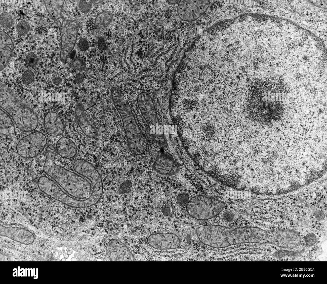 Micrografia elettronica (EM) di cellule epatiche umane (epatociti). Foto Stock