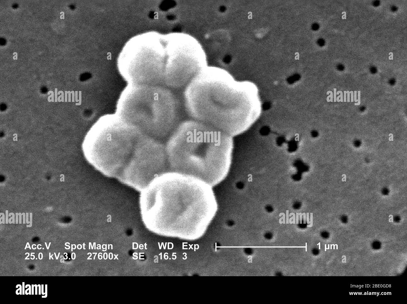 Questo SEM raffigura un gruppo molto ingrandito di batteri acinetobacter baumannii Gram-negativi, non-motile; Mag - 27600x. I membri del genere Acinetobacter sono verghe non mottili, di 1-1.5µm di diametro e di 1.5-2.5µm di lunghezza, diventando di forma sferica durante la loro fase stazionaria di crescita. Gli spinetobacter spp. Sono ampiamente distribuiti in natura, e sono normali flora sulla pelle. Alcuni membri del genere sono importanti perché sono una causa emergente di infezioni polmonari acquisite in ospedale, ad esempio polmonite, emopatiche e ferite. Foto Stock