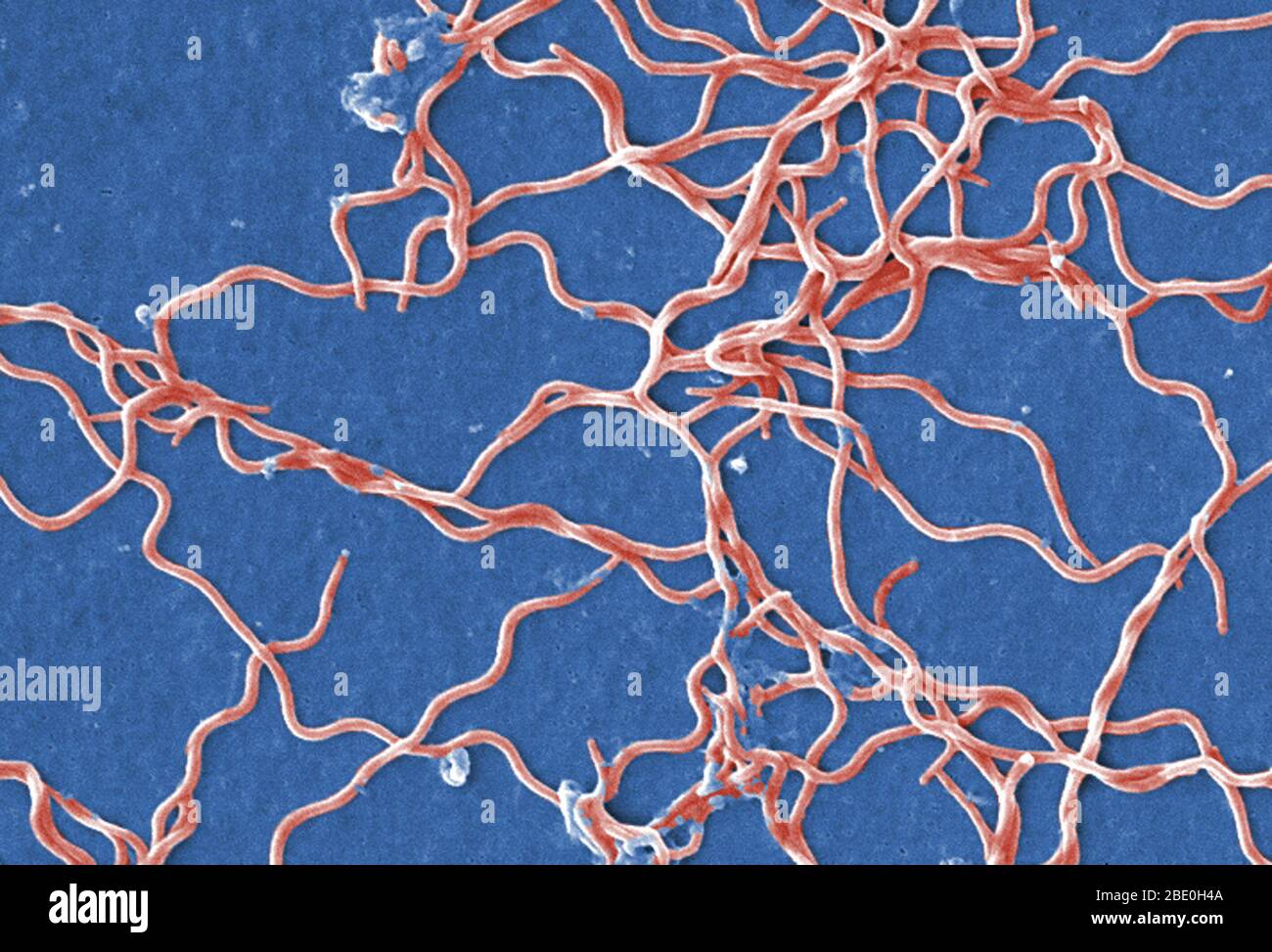 La micrografia elettronica a scansione (SEM) descrive un raggruppamento di numerosi batteri Borrelia burgdorferi, anaerobici, Gram-negativi, che erano stati derivati da una coltura pura. Questo organismo patogeno è responsabile della malattia di Lyme, un disturbo zoonotico, veicolato da vettori, trasmesso all'uomo tramite un morso di zecca. B. burgdorferi appartiene ad un gruppo di batteri chiamati spirochete, il cui aspetto assomiglia ad una molla a spirale. B. i batteri burgdorferi possono infettare diverse parti del corpo, producendo sintomi diversi in momenti diversi. Non tutti i pazienti affetti da malattia di Lyme avranno tutti i sintomi Foto Stock