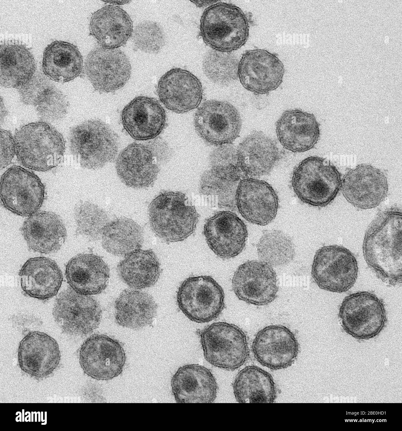 Micrografia elettronica a trasmissione (TEM) che mostra particelle di SIV (Simian Immunodeficiency Virus) mature. Ingrandimento sconosciuto. Foto Stock