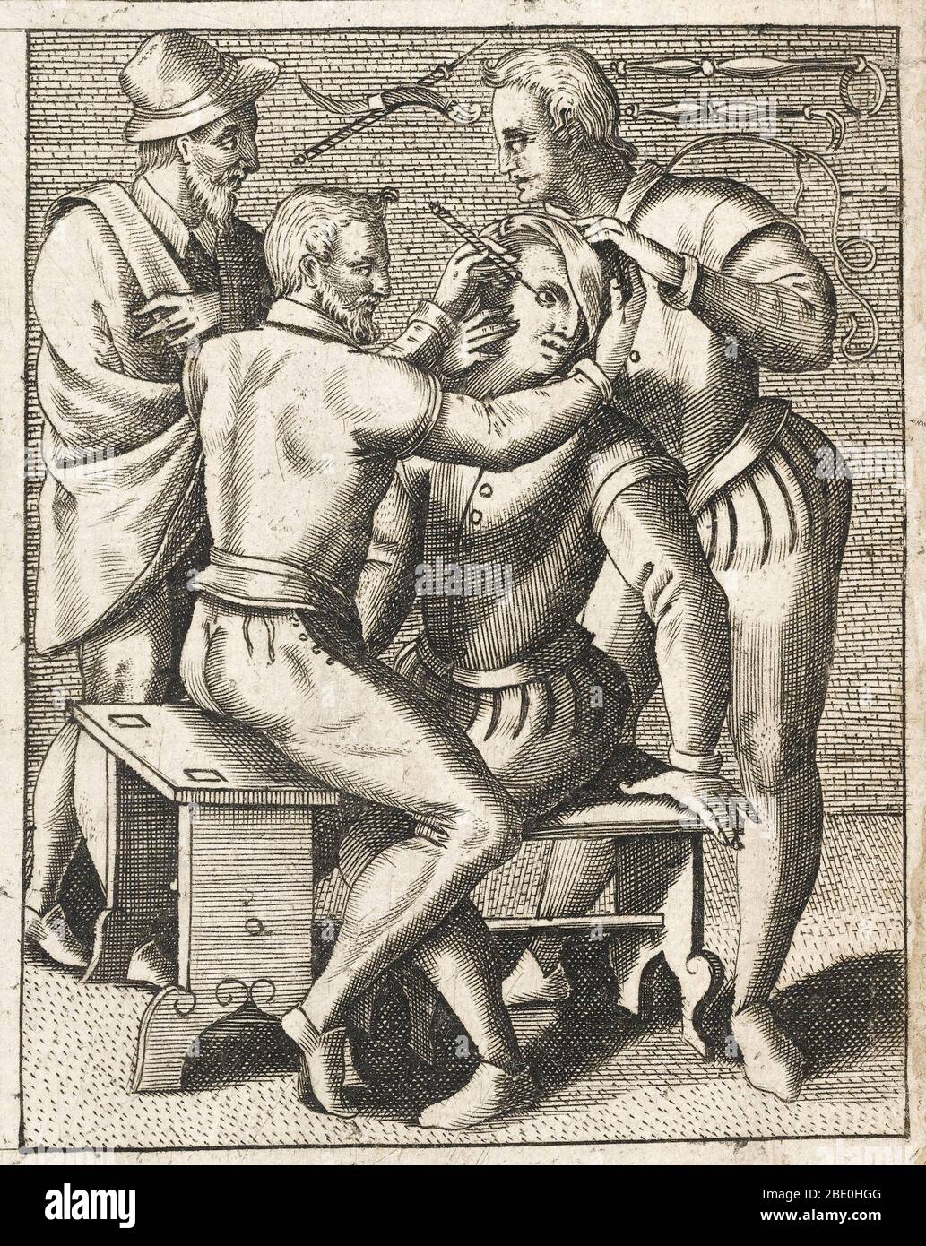 Il paziente viene tenuto in posizione mentre viene eseguita un'operazione sull'occhio, 1594. Sullo sfondo sono illustrate molte tecniche chirurgiche oftalmiche. Foto Stock
