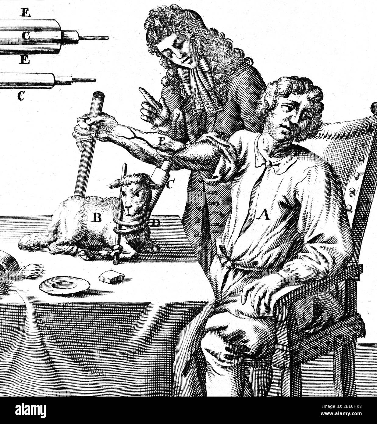 Trasfusione precoce del sangue. Opera storica del fisiologo inglese Richard Lower (1631-1691) che trasfuse sangue in un braccio di un uomo da un agnello nel 1667. L'estremità della provetta utilizzata per perforare i vasi sanguigni e trasferire il sangue si trova in alto a sinistra. Lower ha dimostrato per la prima volta la trasfusione del sangue dall'arteria di un cane alla vena di un altro nel 1665. I tentativi più recenti di altri di trasfondere gli animali negli esseri umani hanno portato a qualche morte. Il Tatise di Lower sul cuore descrive il cuore come una pompa muscolare piuttosto che un organo 'gonfiato dagli spiriti'. Deduceva che il rosso brillante del sangue arterioso Foto Stock