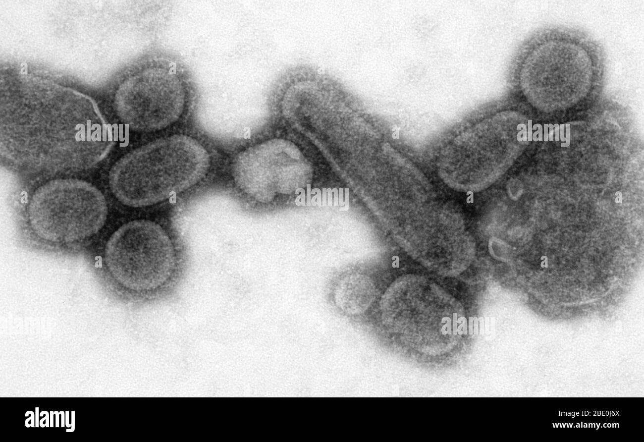 TEM a colorazione negativa mostra 1918 virioni influenzali ricreati che sono stati raccolti dal supernatante di una coltura cellulare di rene di canina di Madin-Darby 1918-infetta, 18 ore dopo l'infezione. Dr.Terrence Tumpey, microbiologo del personale e membro del NCID, ha ricreato il virus influenzale del 1918 per identificare le caratteristiche che hanno reso questo organismo un patogeno mortale. Sforzi di ricerca come questo consentono ai ricercatori di sviluppare nuovi vaccini e trattamenti per i futuri virus dell'influenza pandemica. Ingrandimento sconosciuto. Foto Stock
