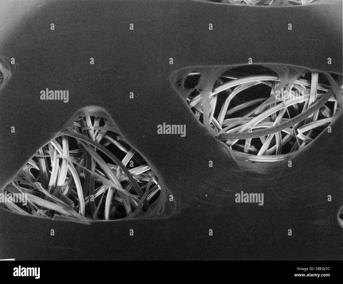 Tampone assorbente a banda di ausilio, visibile sotto un microscopio elettronico a scansione. Lo strato grigio senza caratteristiche è la pellicola non assorbente che impedisce al tampone di aderire ad una ferita. I trefoli convoluti, simili a filo, visti attraverso i fori sono le fibre che rendono il tampone di ausilio alla fascia assorbente. Il lato lungo di ciascun foro triangolare è di circa 400 micron di lunghezza, che è circa la lunghezza di un grano di sale da tavola. (ingrandimento 350x). Foto Stock