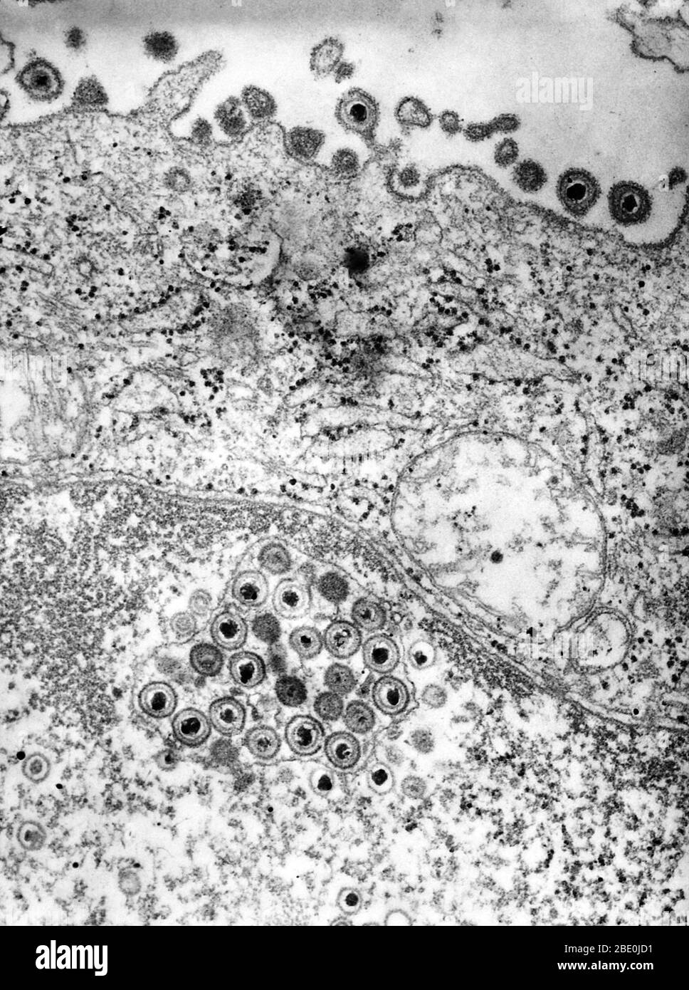 La micrografia elettronica a trasmissione colorata negativa (TEM) rivela la presenza di numerosi virioni herpes simplex, situati sia all'interno del nucleo, sia in questo campione di tessuto. L'herpes genitale è un'infezione genitale causata dal virus herpes simplex (HSV). La maggior parte degli individui che trasportano herpes sono ignari che sono stati infettati e molti non soffriranno mai un'epidemia, che coinvolge le vesciche simili alle piaghe fredde. Mentre non c'è cura per herpes, nel corso del tempo i sintomi sono sempre più blandi e le epidemie sono sempre più frequenti. La manifestazione tipica di un'infezione primaria è indizi Foto Stock