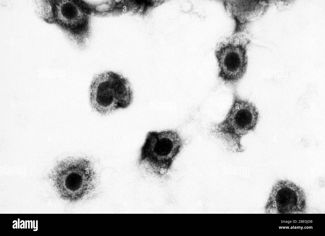 La micrografia elettronica a trasmissione (TEM) mostra un certo numero di virioni citomegalovirus presenti in un campione di tessuto sconosciuto. Il citomegalovirus (CMV) è un genere di virus dell'ordine Herpesvirales, appartenente alla famiglia Herpesviridae, appartenente alla sottofamiglia Betaherpesvirinae. Gli esseri umani e le scimmie servono come ospiti naturali. Il citomegalovirus è un virus del DNA a doppio filamento (dsDNA). Attualmente, in questo genere sono presenti otto specie, tra cui la specie tipo, il citomegalovirus umano (HCMV, herpesvirus umano 5, HHV-5), che è la specie che infetta gli esseri umani. Nella letteratura medica, la maggior parte delle menzioni di CMV senza ulteriori specifiche Foto Stock