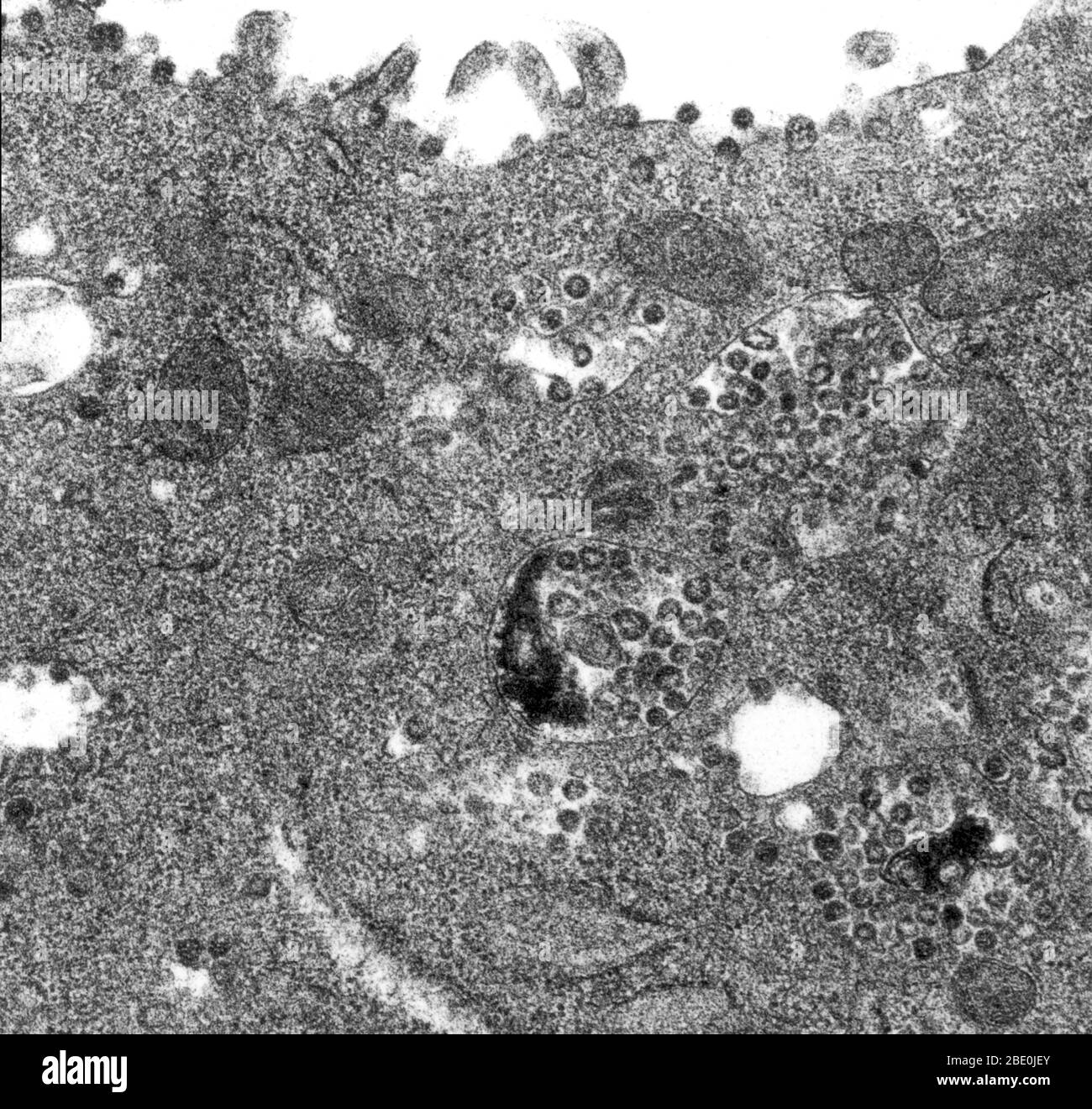 La micrografia elettronica a trasmissione (TEM) di una sezione sottile TEM di una cellula Vero E6 infettata, rivelando la presenza di particelle di coronavirus. Si noti che le particelle virali sono contenute nei vacuoli legati alla membrana citoplasmatica della cellula, e cisternae del reticolo endoplasmatico grezzo. Le cellule vero sono una linea di cellule usate in colture cellulari. I coronavirus sono specie di virus appartenenti alla sottofamiglia Coronavirinae della famiglia Coronaviridae, nell'ordine Nidovirales. I coronavirus sono virus con involucro con un genoma di RNA a singolo filamento e senso positivo e con un nucleocapside di simm elicoidale Foto Stock
