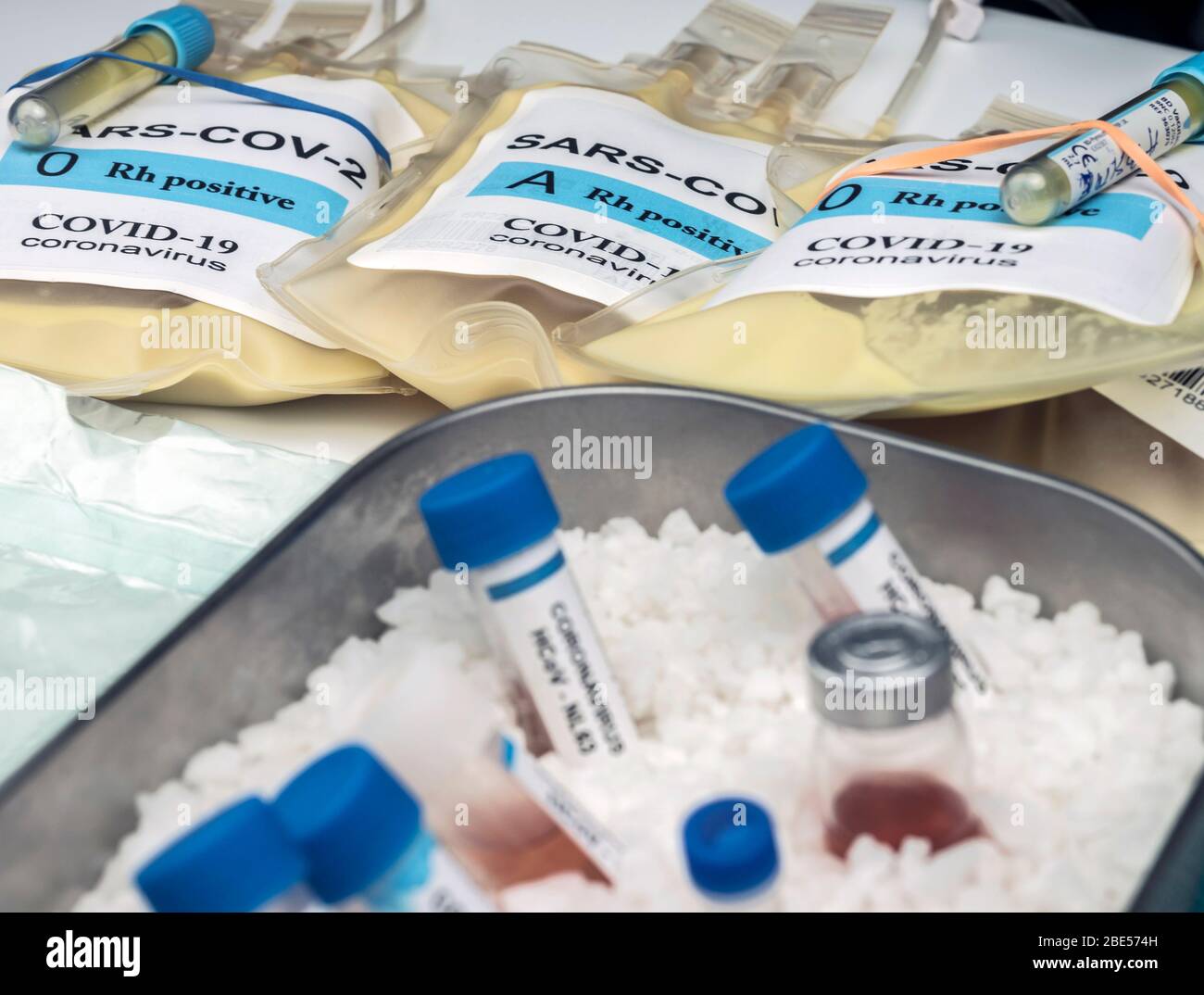 Sacca per plasma con anticorpi da persone curate di SARS-COV-2 Covid-19 preparata in un'immagine concettuale ospedaliera Foto Stock