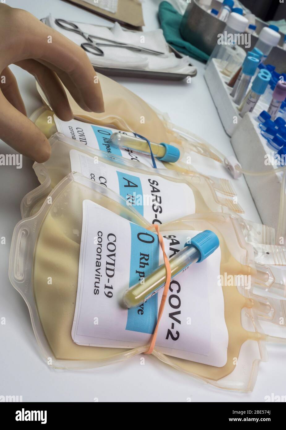 Sacca per plasma con anticorpi da persone curate di SARS-COV-2 Covid-19 preparata in un'immagine concettuale ospedaliera Foto Stock