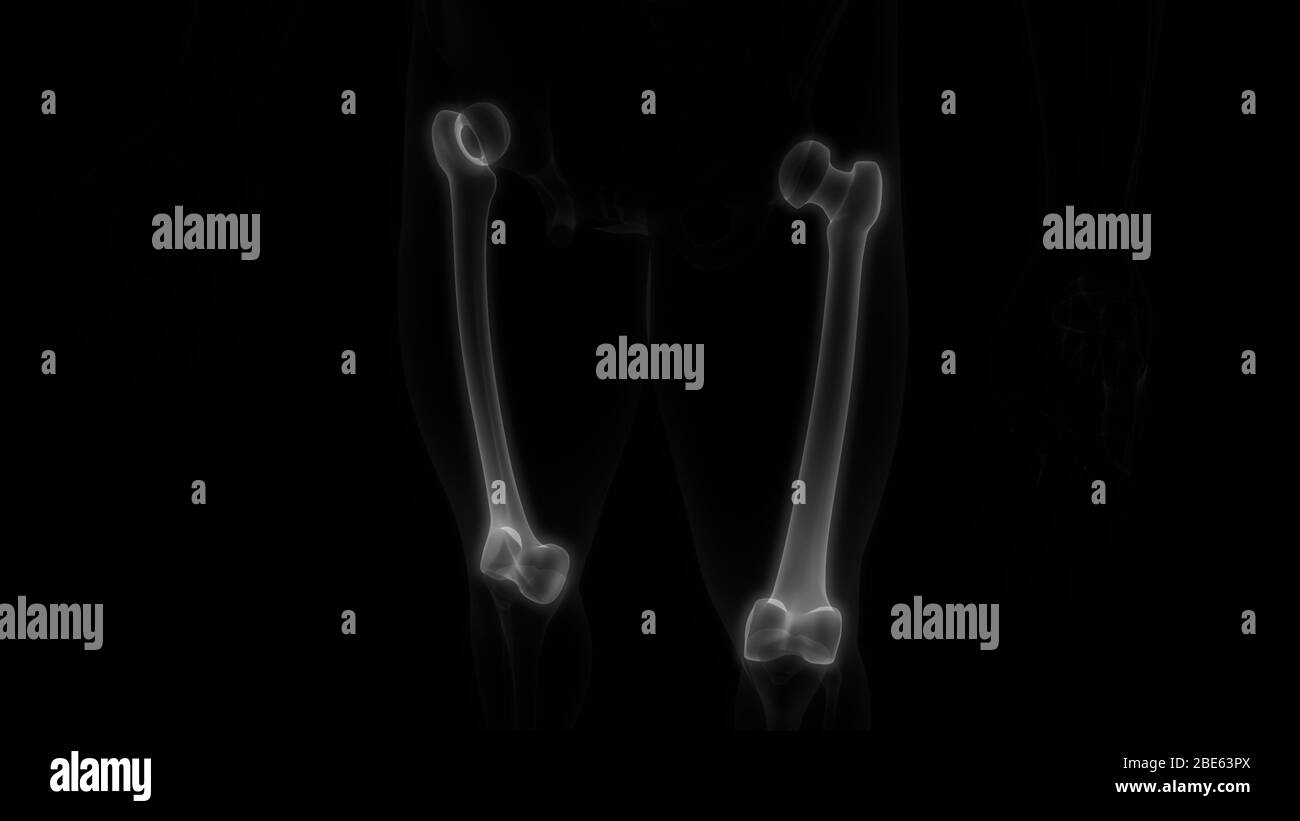 Sistema scheletrico umano giunti ossei femorali anatomia radiografica 3D. Foto Stock