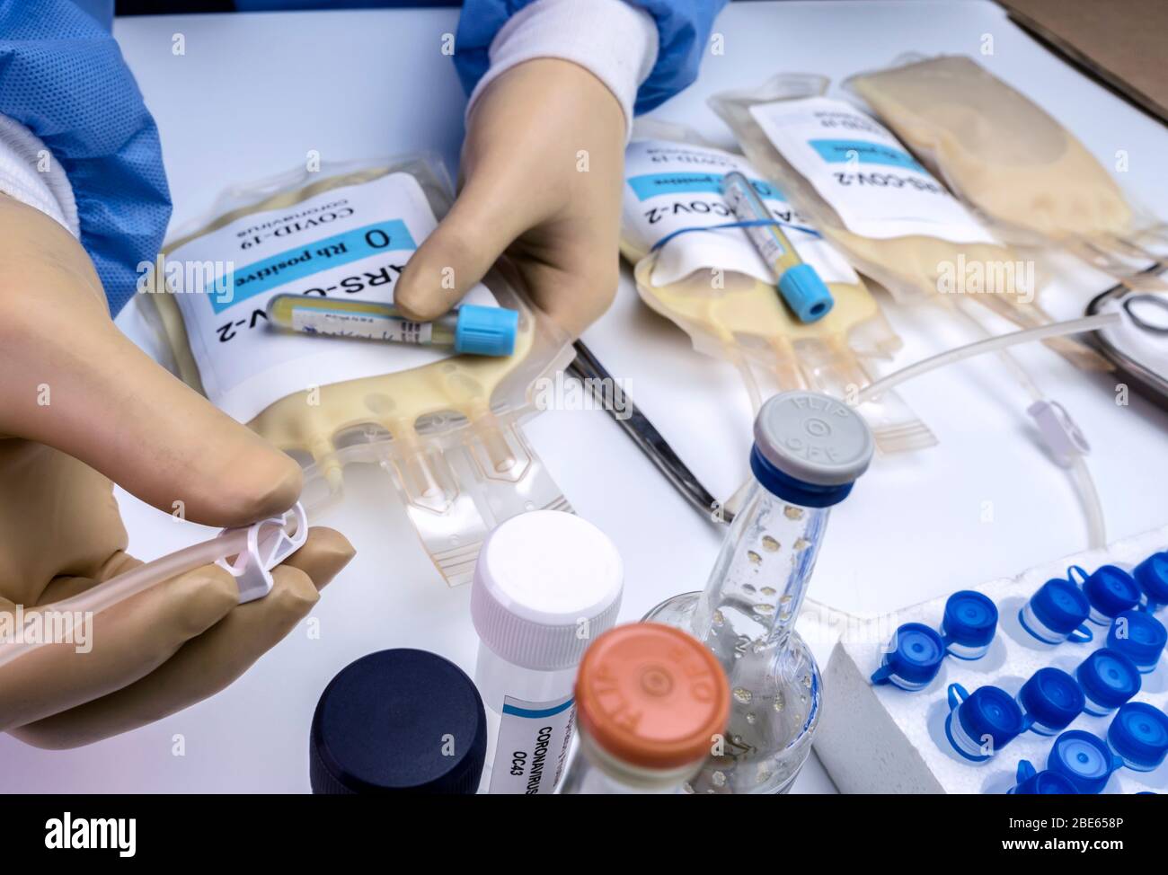 Sacca per plasma con anticorpi da persone curate di SARS-COV-2 Covid-19 preparata in un'immagine concettuale ospedaliera Foto Stock