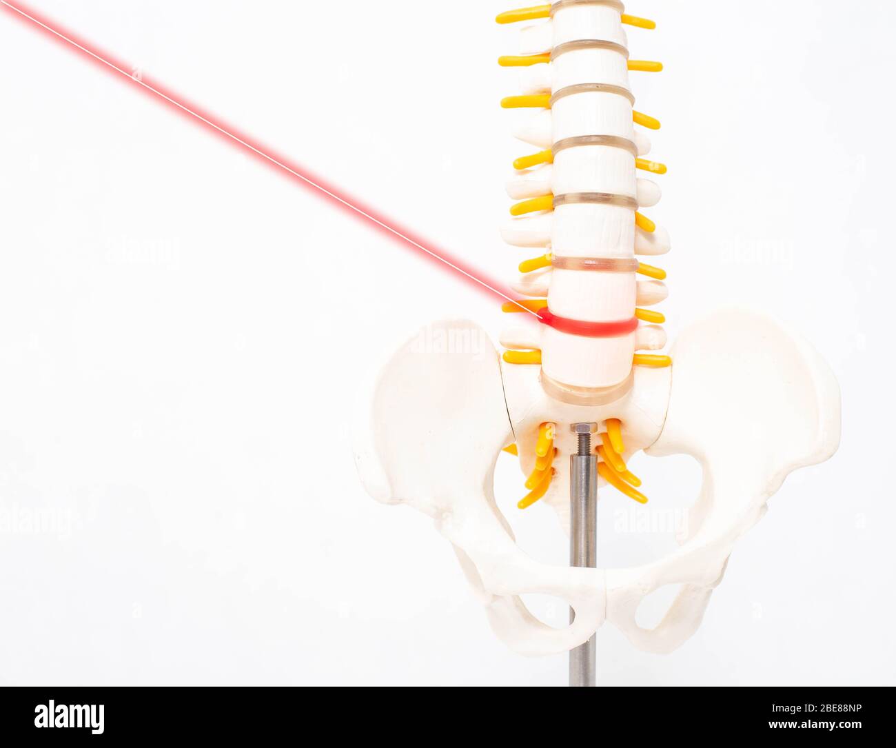 Mock su colonna vertebrale umana su uno sfondo bianco con un laser. Il concetto di un nuovo metodo moderno senza intervento chirurgico per il trattamento e la rimozione dell'interverte Foto Stock