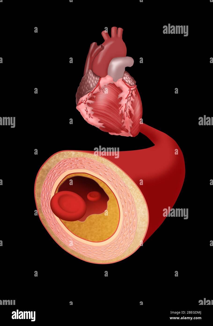 Cuore e arteria Foto Stock