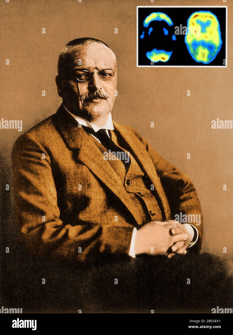 Alois Alzheimer con scansioni PET Foto Stock
