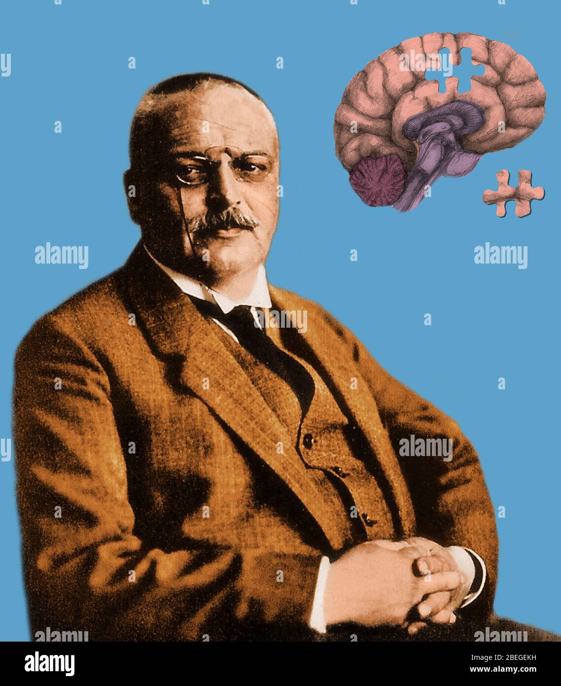 Alois Alzheimer e Puzzle cervello Foto Stock
