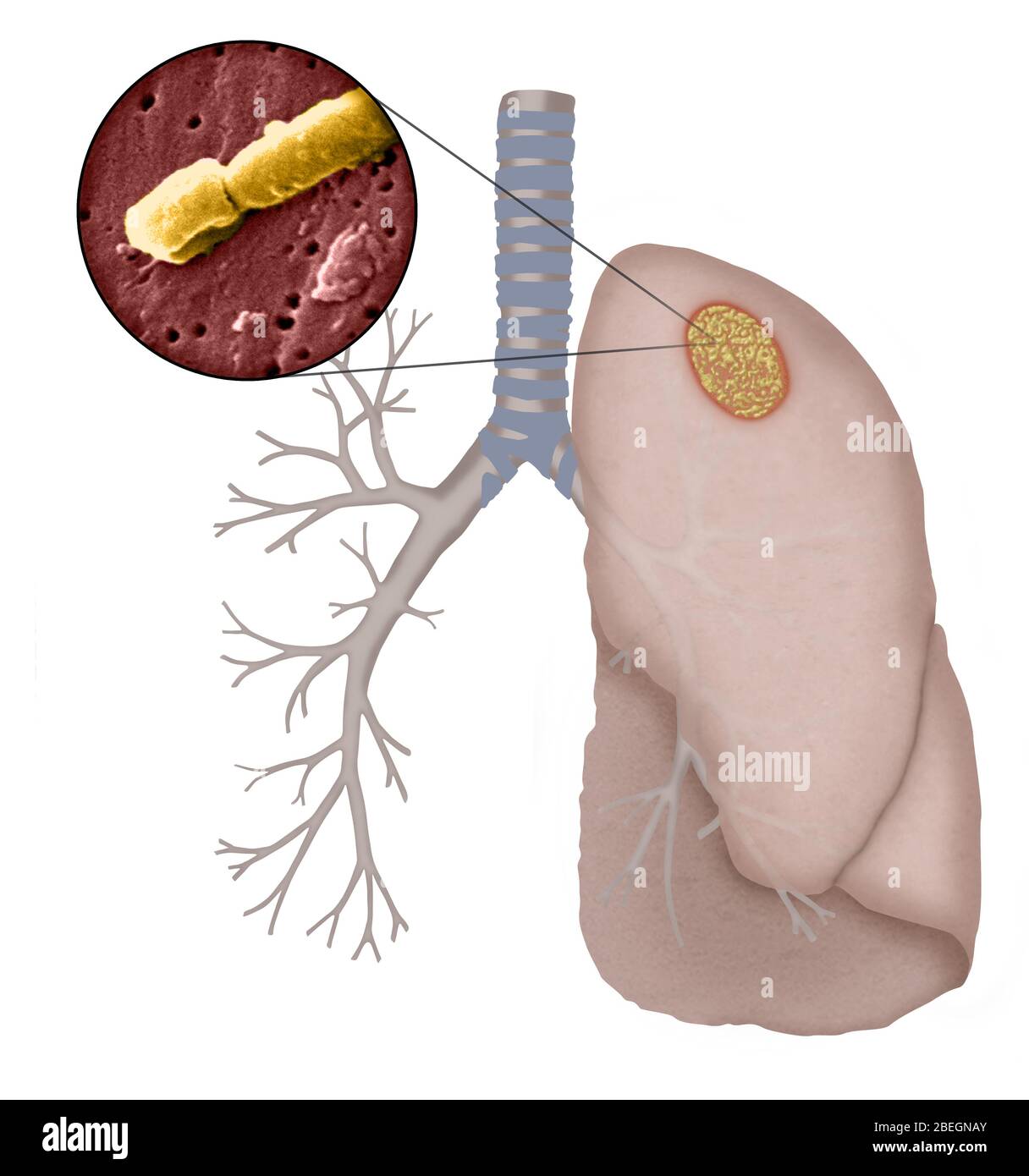 Klebsiella pneumoniae Foto Stock
