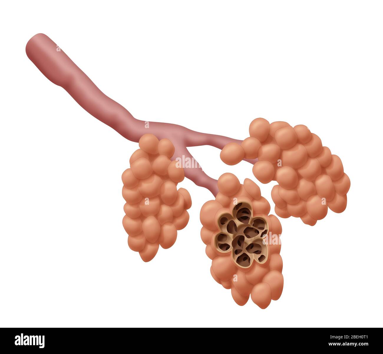 Alveoli danneggiati Foto Stock