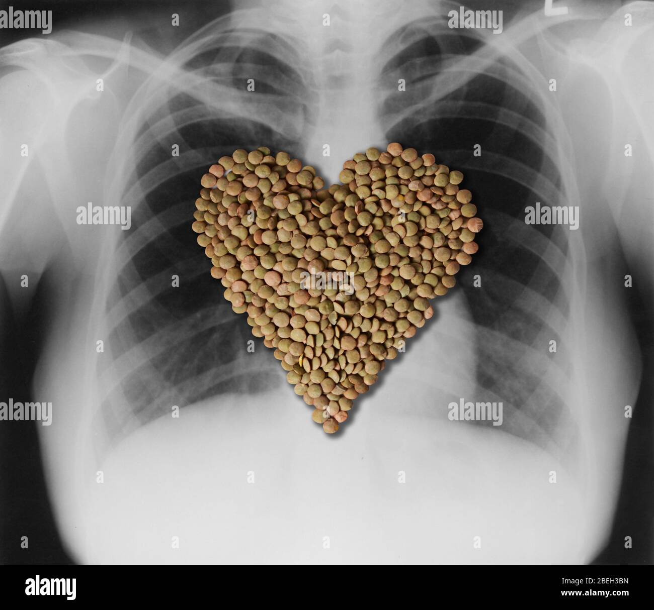 Lenticchie, cuore-sano alimentare Foto Stock