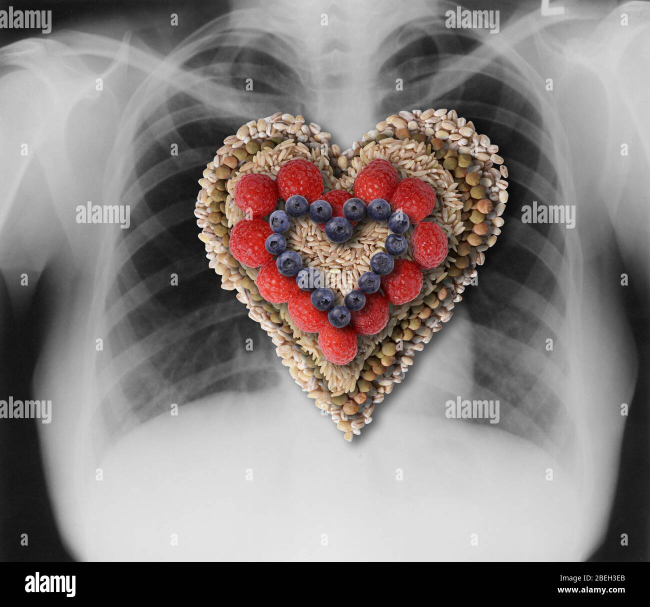 Petto raggi X e cuore sano alimenti Foto Stock
