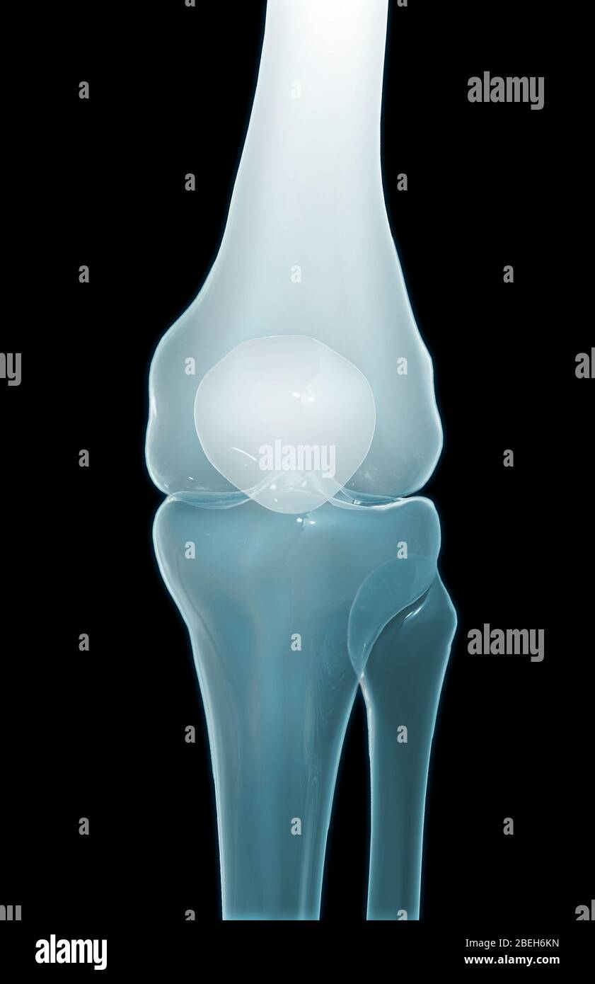 Ossa del ginocchio, vista anteriore Foto Stock