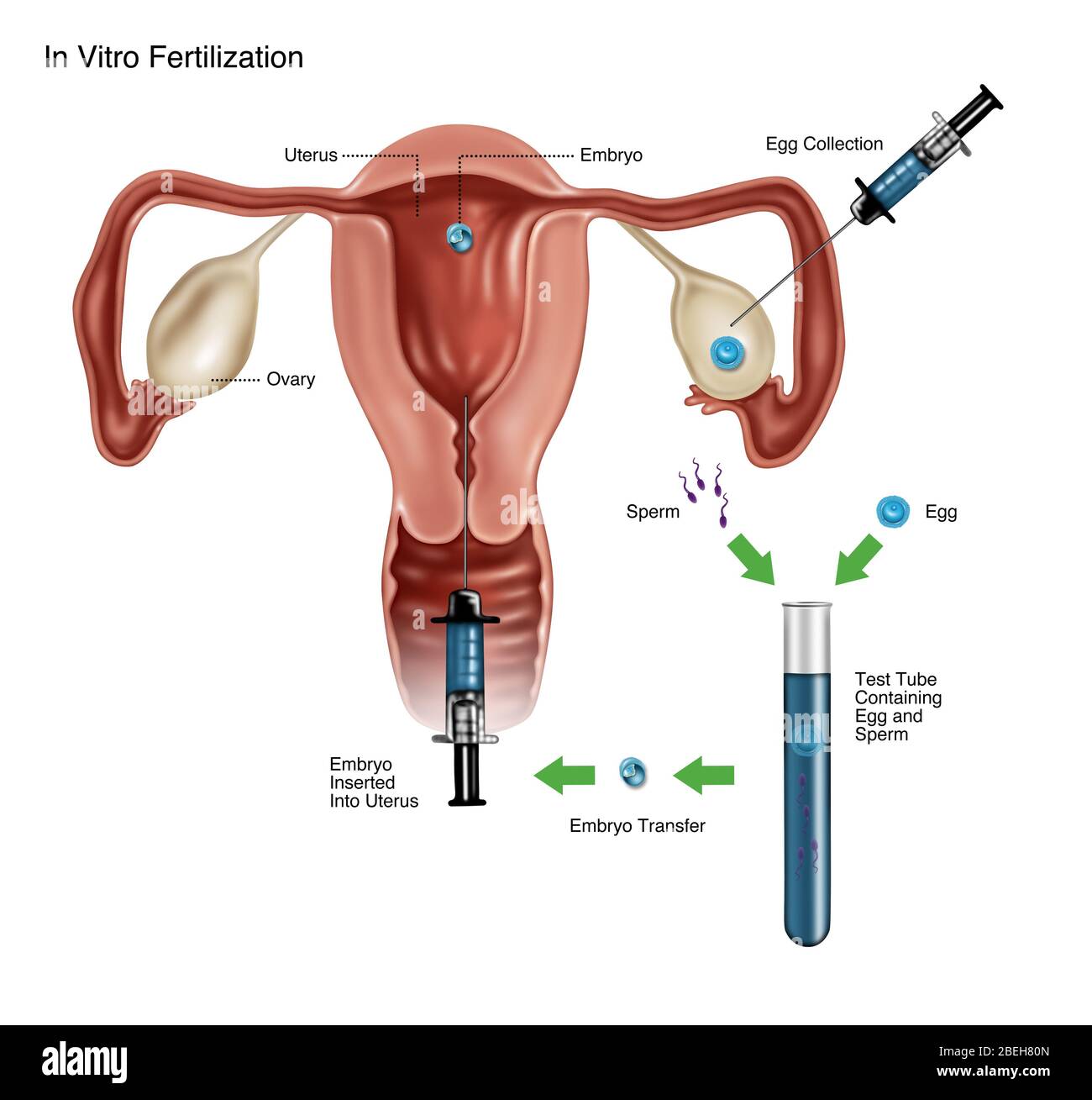 Fertilizzazione in vitro Foto Stock