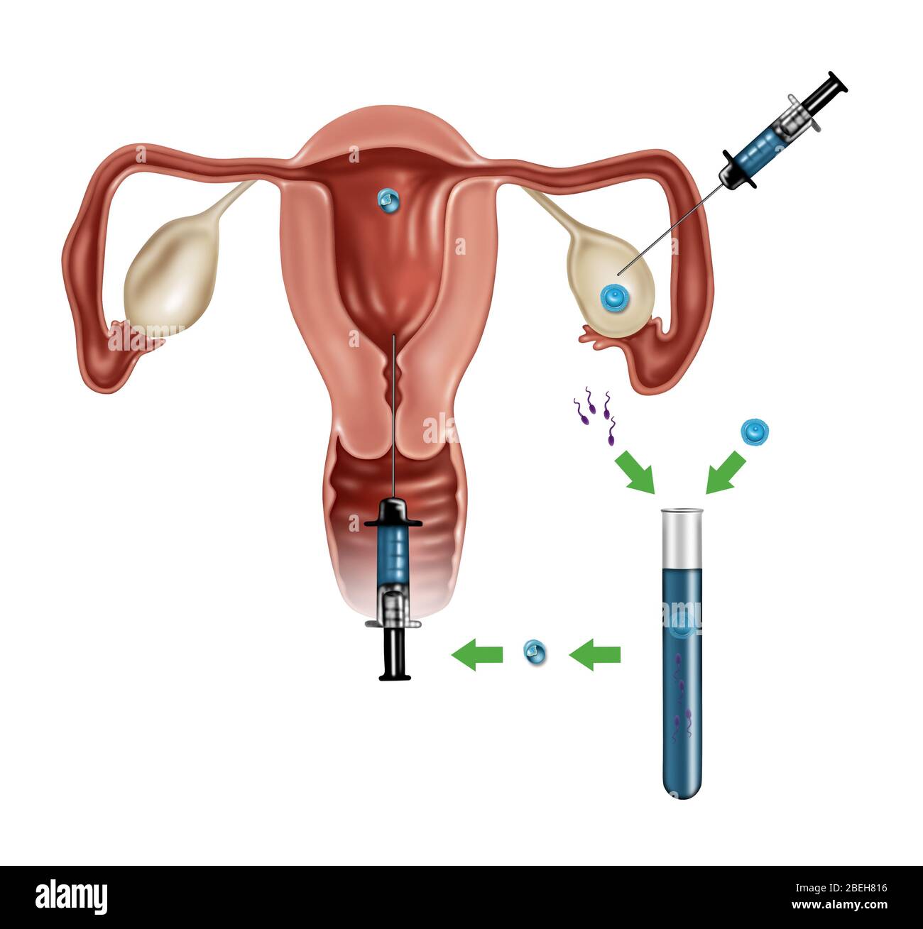 Fertilizzazione in vitro Foto Stock
