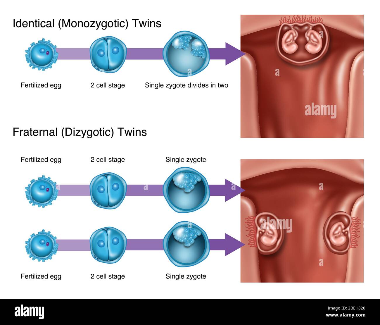 Sviluppo di Twins, illustrazione Foto Stock