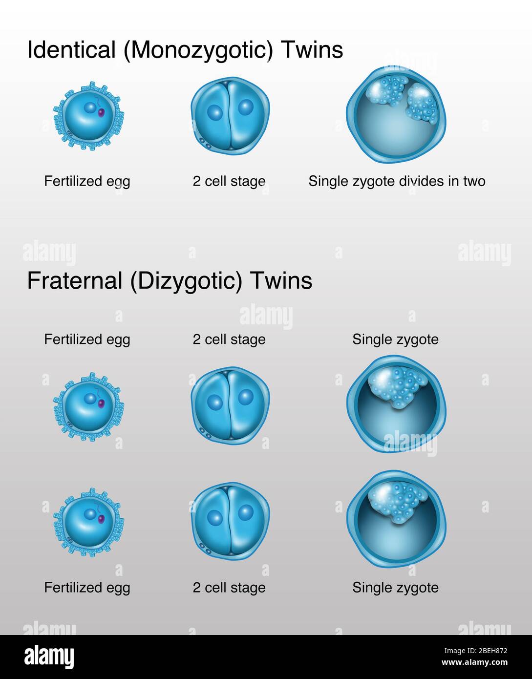 Sviluppo di Twins, illustrazione Foto Stock
