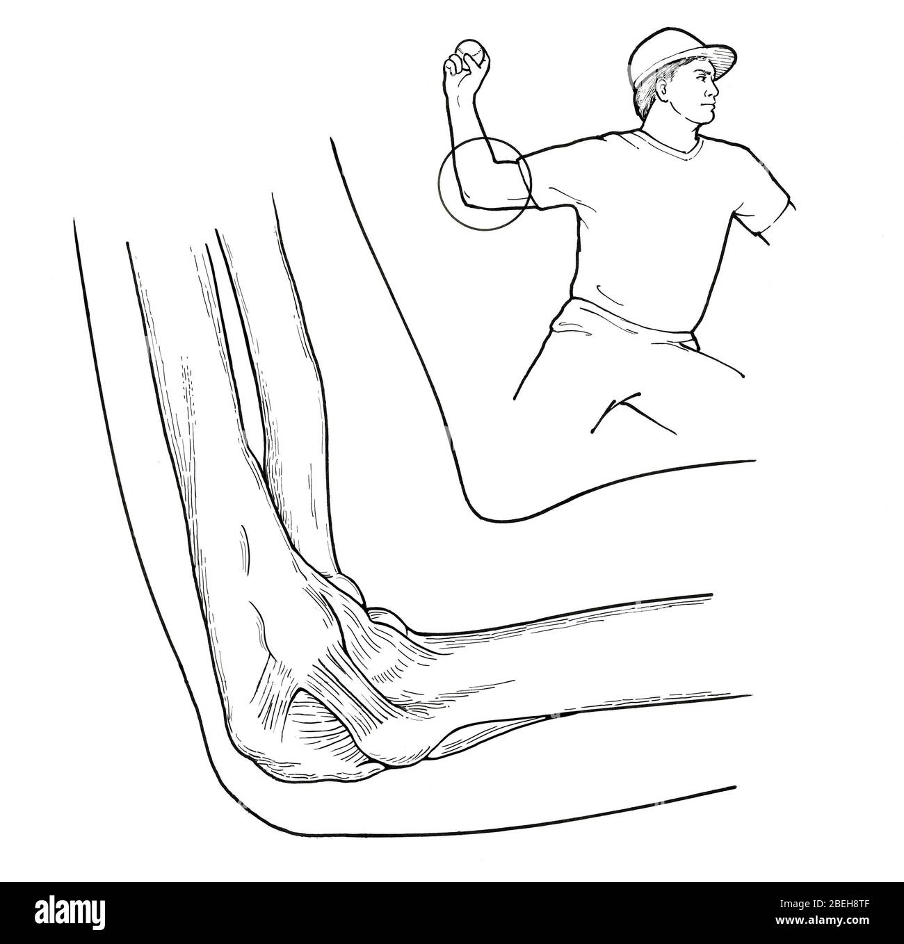 Legamento laterale ulnare, Passitro, Baseball Foto Stock