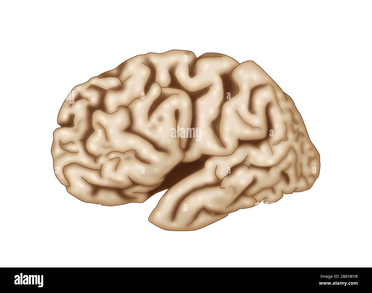 Cervello affetto dalla malattia di Alzheimer. Foto Stock