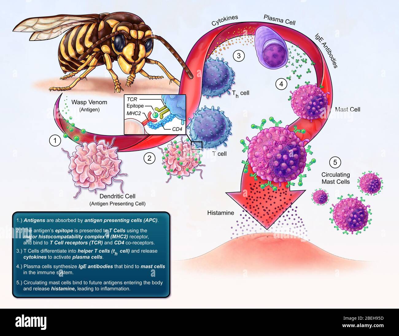 Sviluppo di allergia, illustrazione Foto Stock